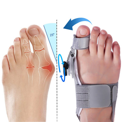 Treatmedy™ Bunion Fix - Natural At-Home Bunion Relief